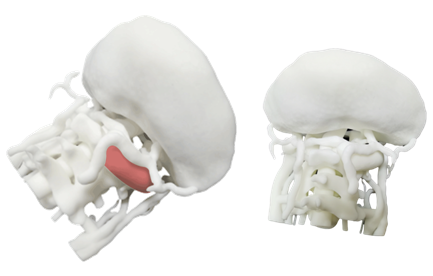 SLA 3D печать в медицине